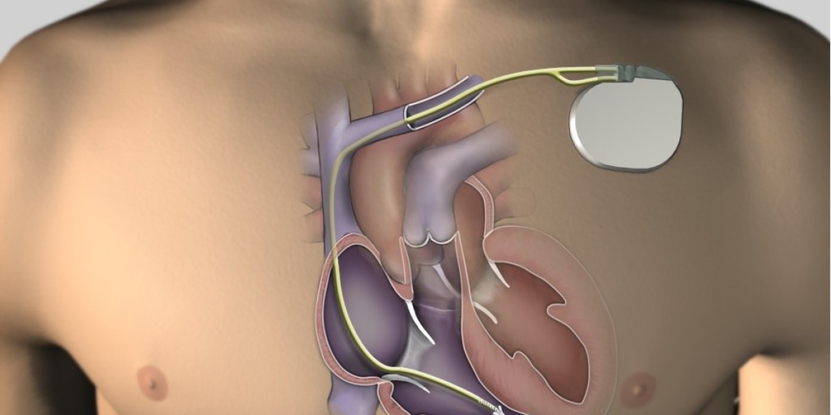 Artificial Cardiac Pacemaker Market Solutions and Services to 2031